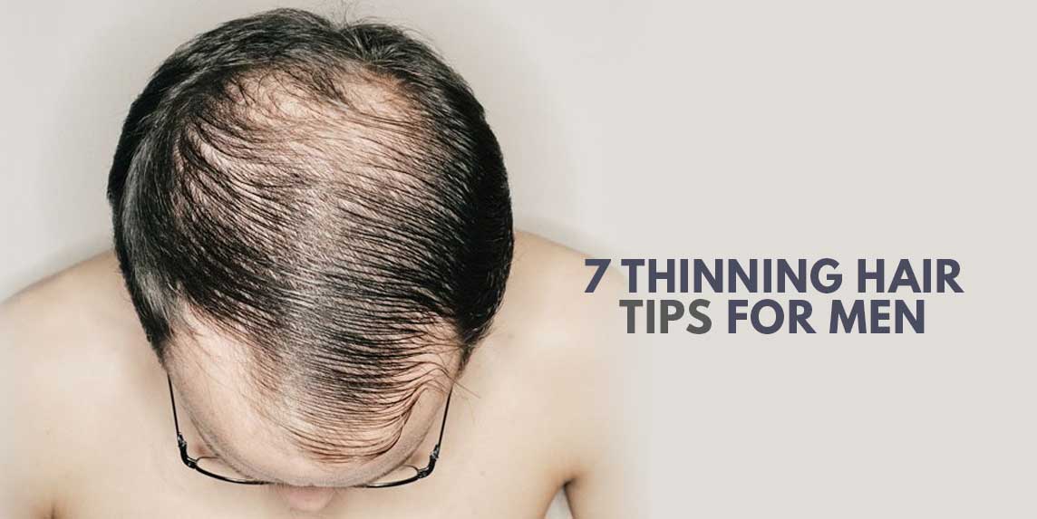 7 Thinning Hair Tips for Men to Avoid Young Baldness ...