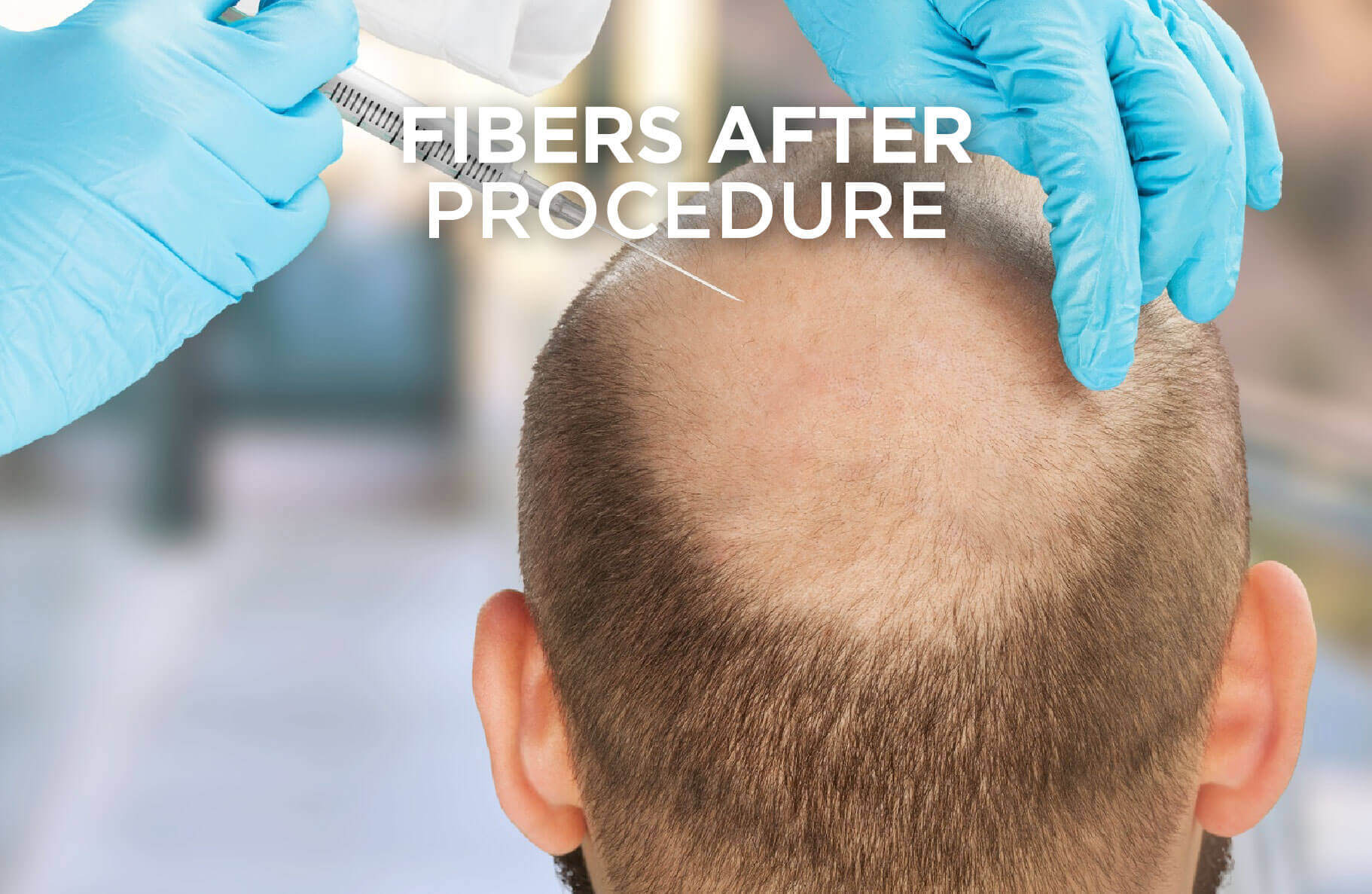 Hairatin Hair Building Fibers and Aging Hair Solutions for Men and