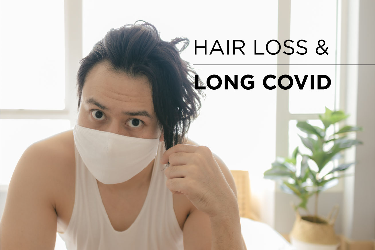 hair loss with long covid